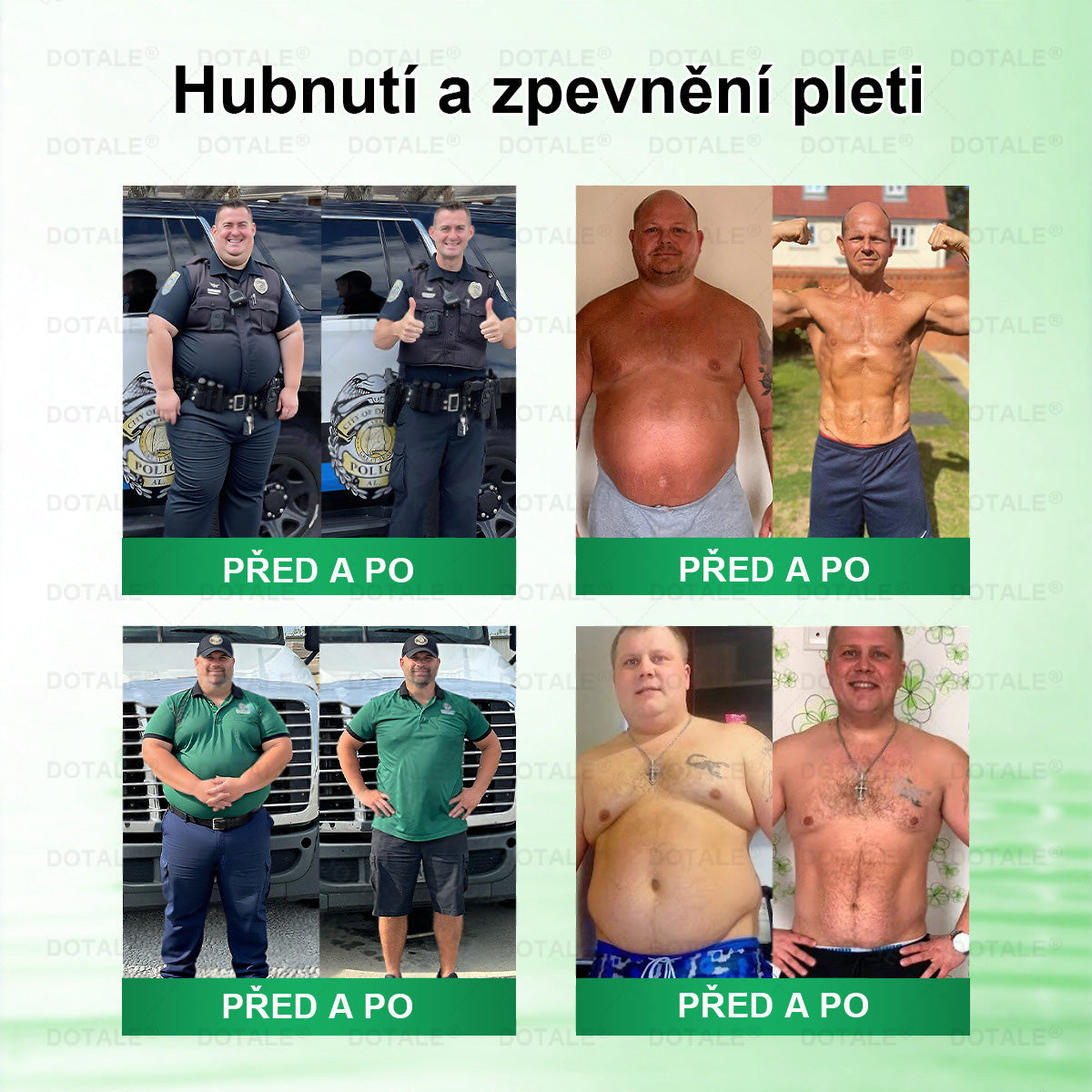 💥𝑫𝑶𝖳𝖠𝐋𝐄® metabolická nano mikrojehličková náplast 🎁 (Pouze jednou denně, viditelné výsledky již do 7 dnů!) ✅ Formule Berberin + Moringa, ideální při nadváze, nedokonalostech pokožky, diabetu, spánkové apnoe a kloubních potížích 💥💥