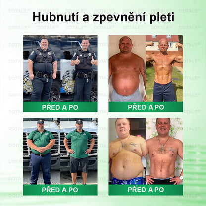 💥𝑫𝑶𝖳𝖠𝐋𝐄® metabolická nano mikrojehličková náplast 🎁 (Pouze jednou denně, viditelné výsledky již do 7 dnů!) ✅ Formule Berberin + Moringa, ideální při nadváze, nedokonalostech pokožky, diabetu, spánkové apnoe a kloubních potížích 💥💥
