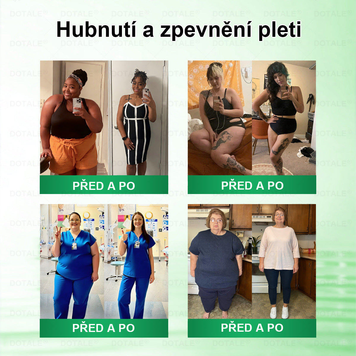 💥𝑫𝑶𝖳𝖠𝐋𝐄® metabolická nano mikrojehličková náplast 🎁 (Pouze jednou denně, viditelné výsledky již do 7 dnů!) ✅ Formule Berberin + Moringa, ideální při nadváze, nedokonalostech pokožky, diabetu, spánkové apnoe a kloubních potížích 💥💥