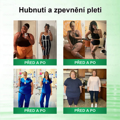 💥𝑫𝑶𝖳𝖠𝐋𝐄® metabolická nano mikrojehličková náplast 🎁 (Pouze jednou denně, viditelné výsledky již do 7 dnů!) ✅ Formule Berberin + Moringa, ideální při nadváze, nedokonalostech pokožky, diabetu, spánkové apnoe a kloubních potížích 💥💥