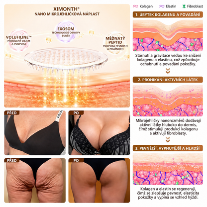 𝐗𝐈𝐌𝐎𝐍𝐓𝐇®🏆 Náplast s nano mikrojehličkami pro objem, pozvednutí a zpevnění poprsí Volufiline + Exosome + Copper Peptide formule poháněná technologií buněčné obnovy